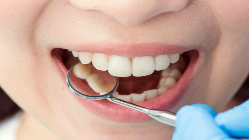 العناية بالأسنان... عادة صحية تحافظ على الجمال وتقي من الأمراض