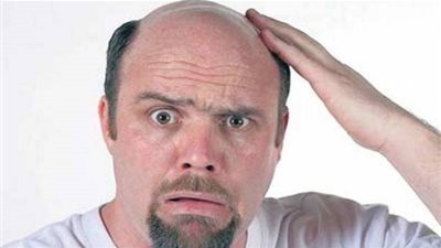 الثوم والجرجير.. لعلاج جميع أنواع الصلع للرجال