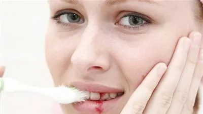   طرق طبيعية للتخلص من نزيف اللثة	