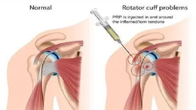 استشاري عظام: 