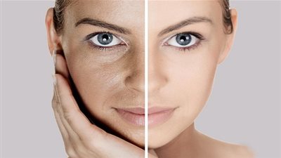 4 نصائح بسيطة لشد مسام البشرة