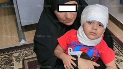 ضبط متسولة تدعي إصابة نجلها في رأسه بمحطة دار السلام