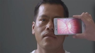 تطبيق جديد للكشف المبكر عن أمراض العين  