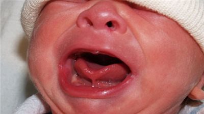 10 نصائح فعالة لمواجهة 