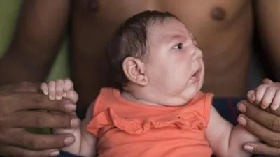 نيويورك تعلن عن أول مولود مصاب بزيكا