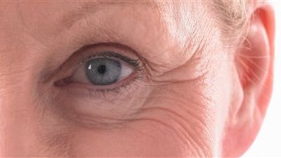 10 نصائح فعالة للوقاية من تجاعيد الوجه 