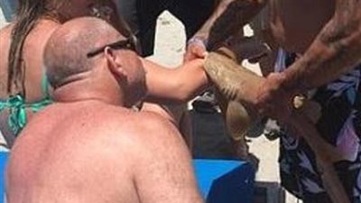   امرأة تعرضت لعضة قرش ويرافقها إلى المستشفى 