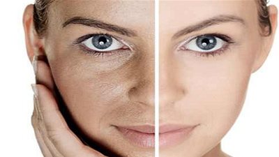 5 علاجات منزلية لشد مسام البشرة