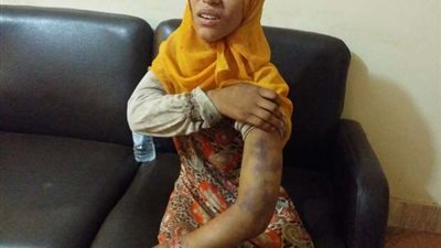 للمرة الثانية..