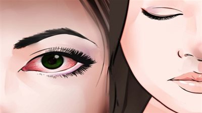  4 نصائح فعالة لعلاج التهابات العيون 