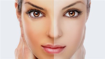 4 علاجات طبيعية لتفتيح البشرة