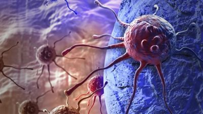 10 علامات تدل على الإصابة بمرض السرطان 