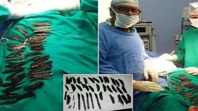 هندي يبتلع السكاكين المعدنية الحادة .. والسبب غريب! 