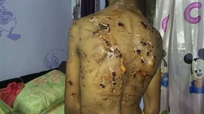 أب يتجرد من كل معاني الإنسانية ويعذب ابنه بالكهرباء (صور)