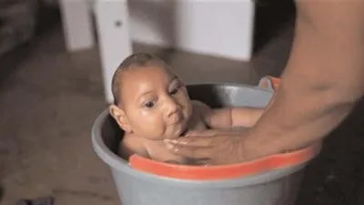 ماليزيا: ارتفاع عدد المصابين بفيروس زيكا