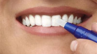 تعرفي على أضرار استخدام منتجات تبييض الأسنان