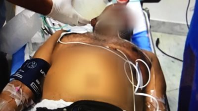 الهلال الأحمر ينقذ ستينيا توقف قلبه أثناء الطواف