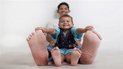 هل تعلم من هو صاحب أكبر قدمين في العالم؟