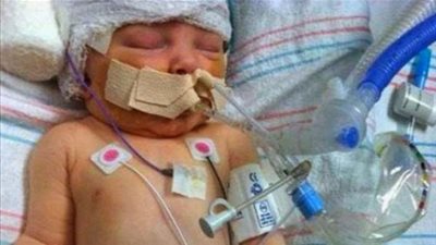 رجل بلجيكي كسر جمجمة طفله الرضيع .. والسبب صادم!