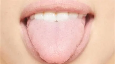 6 علامات باللسان تدل على الصحة العامة للجسم