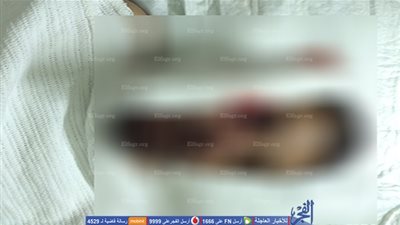 تقرير عاجل للقوى العاملة عن إصابة مصري بطلق ناري في الكويت 