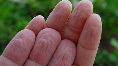 أسباب تجاعيد جلد أطراف الأصابع في الماء