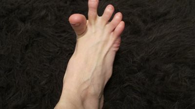 ثلاث نصائح للتخلص من التشنج أو الشد العضلى المؤلم  