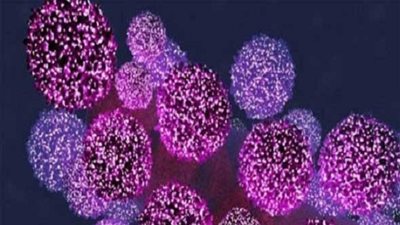 دراسة .. توضح أن واحد من كل 10 أطفال لديه 