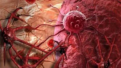 8 طرق بسيطة تقي من الإصابة بالسرطان