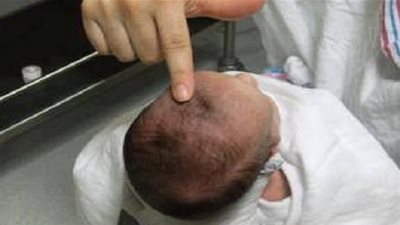 لماذا يحذر الاطباء من لمس قمة رأس طفل حديث الولادة؟