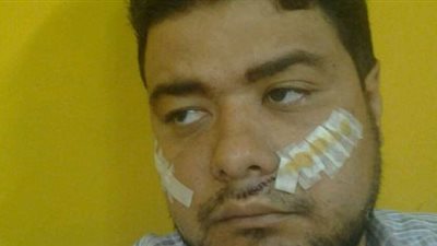 بعد الاعتداء عليه..