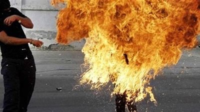 الكشف عن هوية الشاب مضرم النيران في جسده بالإسكندرية