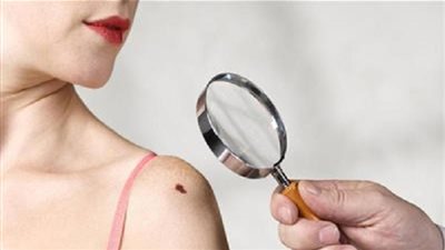 دراسة .. الأثرياء أكثر عرضة لمرض السرطان