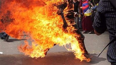 شقيق الشاب المحترق يكشف تفاصيل جديدة حول حالته الصحية