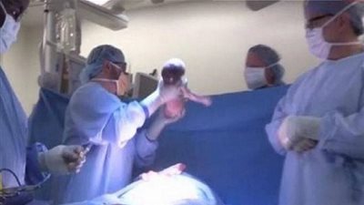 طفلة خرجت من رحم أمها وعادت مرة اخرى لتكمل حياتها! (صور)