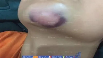 إصابة طالب بمدرسة روتس اسكول بعد سقوط عمود كهرباء عليه (صور) 