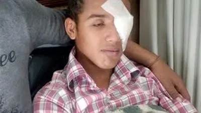 تصفية عين طالب بالصف الأول الثانوي.. وولي الأمر يستغيث بالوزارة 