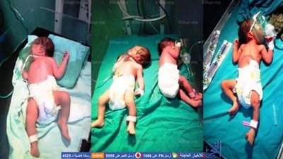 سيدة تنجب توأمين في أول حمل لها ببني سويف.. و