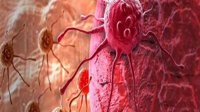 علاج جديد قد يقلل من خطر الإصابة بالسرطان