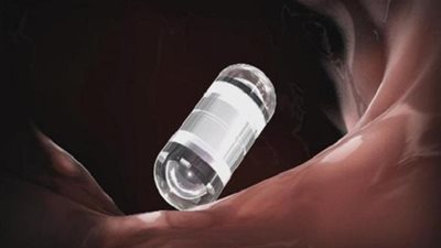 باحثون يكتشفون كبسولة علاجية تبقى في الجسم لأسابيع لمكافحة الإيدز والملاريا