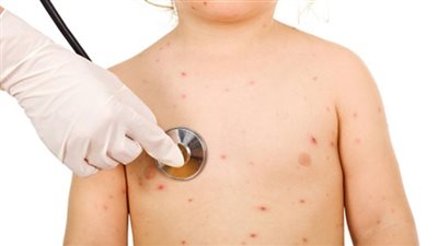 إصابة 13 تلميذا بـ