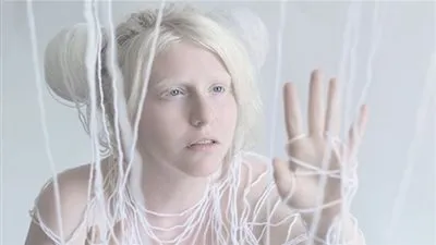 مصورة إسرائيلية تبرز الوجه الآخر لمرضى 