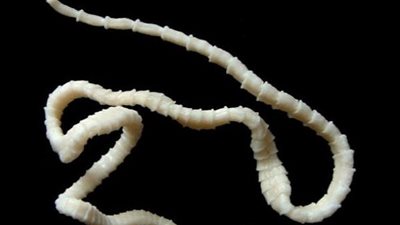 6 علامات خطيرة للإصابة بـ