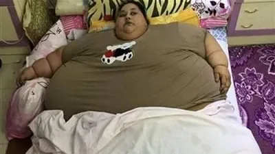 الهند تعرض المساعدة في علاج أسمن امرأة مصرية في العالم (فيديو)