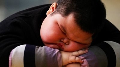 امراض ناتجة عن سوء التغذية.. أبرزها 