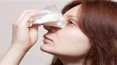 7 أسباب شائعة لنزيف الدم من الأنف