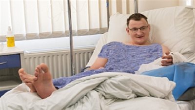 أول عملية زراعة كف اصطناعي في العالم.. تتم بنجاح