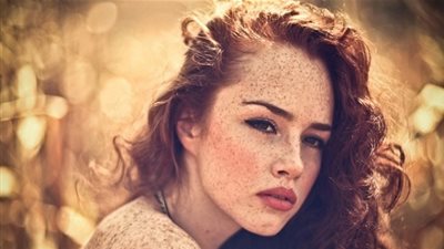 وصفة سحرية لعلاج النمش بسهولة