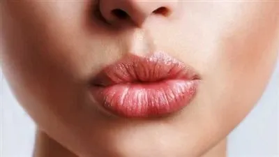 تعرفي على سر لون الشفاه واختلافها عن بقية الجلد