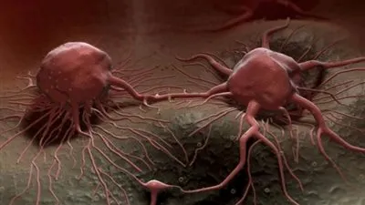 اسباب مرض السرطان.. معرفتها تحمي من الاصابة !